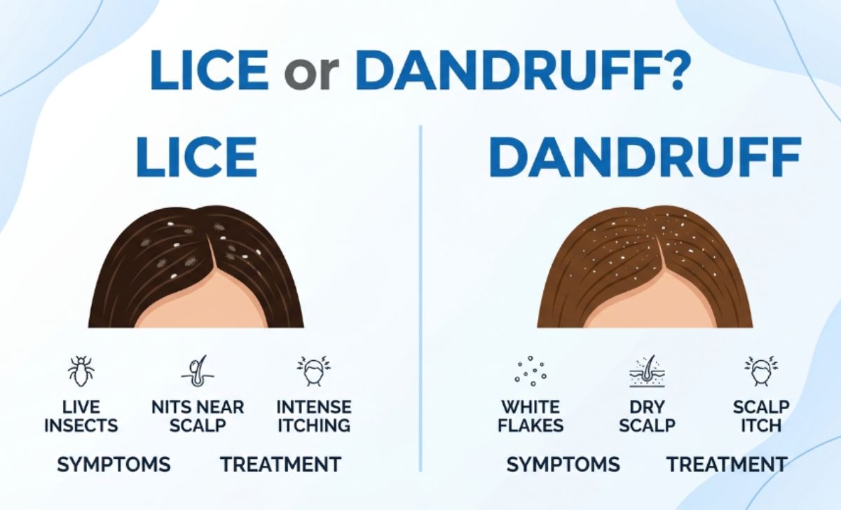Lice or Dandruff